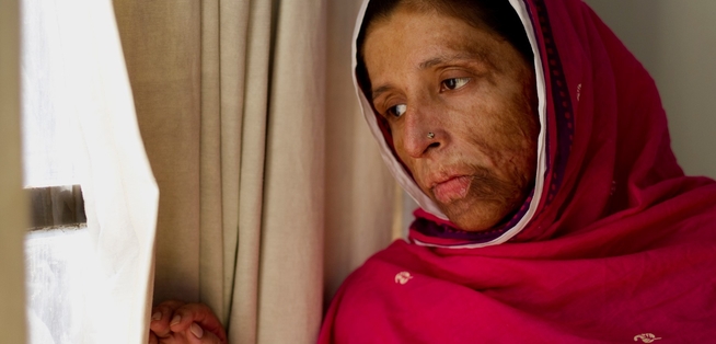 Saving Face 3